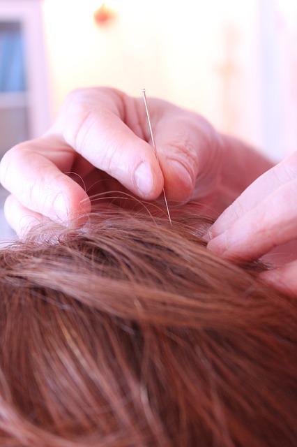 neuro-acupuncture in Brooklyn